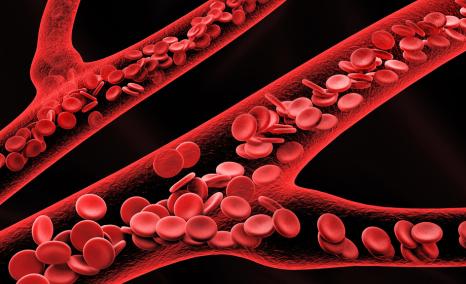 Polycythemia Vera: Growing Competition and the Changing Treatment Landscape in 2025